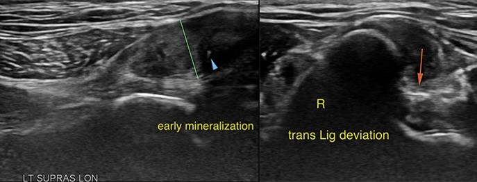 https://www.vetinare.de/media/11/4e/2d/1732899997/W337-Orthopaedische-Sonographie-2-2.jpg