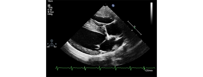 https://www.vetinare.de/media/3e/c5/19/1732900161/W426-Echokardiographie-des-rechten-Herzens-1.jpg