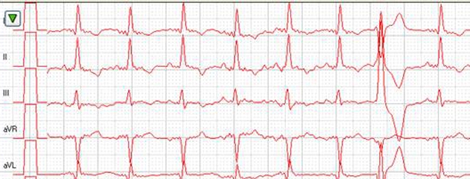 https://www.vetinare.de/media/b0/5d/40/1732900093/W390-EKG-bei-der-Katze-1.jpg